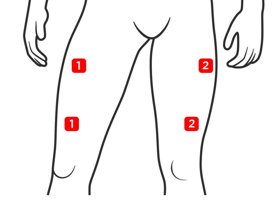 Electrodes Placement CareMax AU