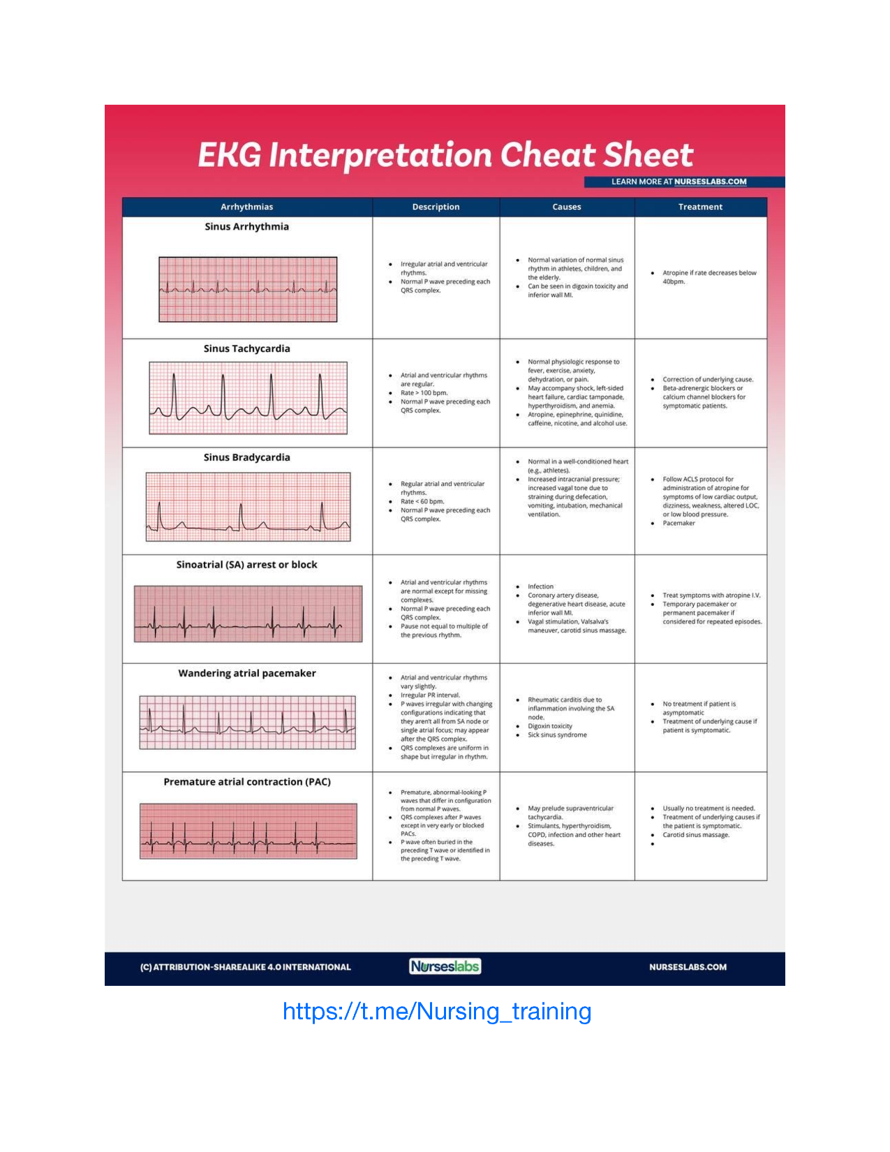 Printable Ekg Interpretation Cheat Sheet